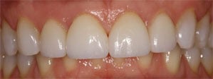 Patient's smile after dental treatment