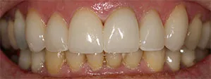 Patient's smile after dental treatment