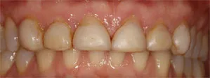 Patient's smile before dental treatment
