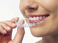 Woman holding Invisalign clear braces